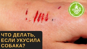 Чем обработать рану после укуса