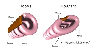 Частота заболевания у собак Причины возникновения Коллапса