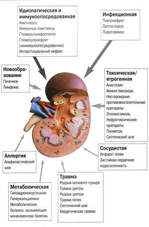 Ранняя диагностика хронической почечной недостаточности Ранняя диагностика почечной недостаточности